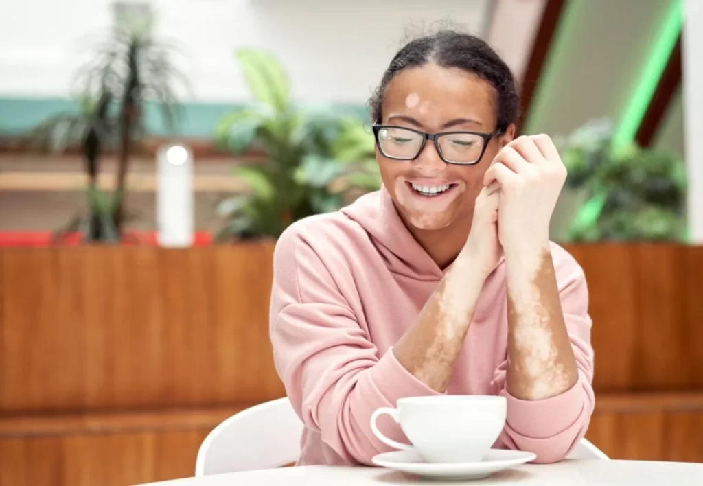 Black african american woman with vitiligo pigmentation skin problem indoor dressed pink hoodie glasses sitiing table indoor drink tea smiling Happy positive person waiting in restaurant