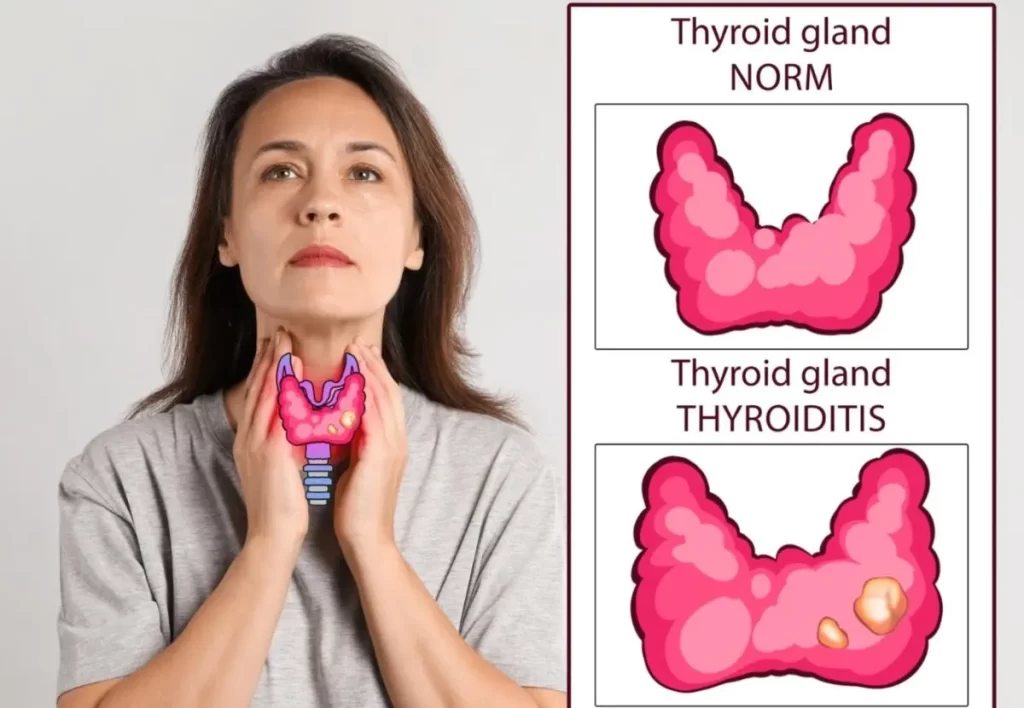 Woman and illustration of thyroid gland on white background